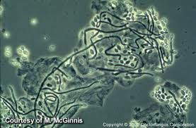 bacteria under a microscope